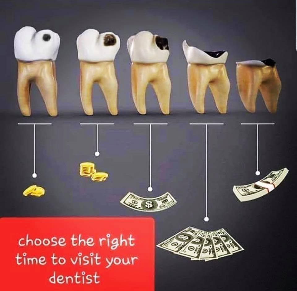 Cost-of-Teeth.jpg