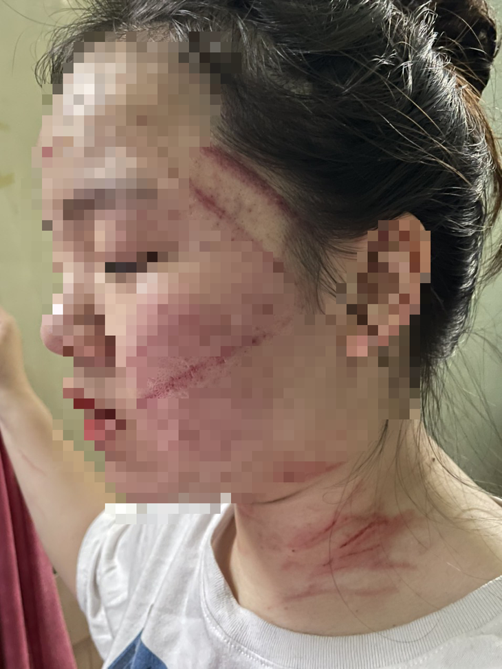Vụ thiếu nữ 17 tuổi bị mẹ ruột trói, đánh: Điều tra thêm hành vi bạo hành, ngược đãi con cái - Ảnh 1.