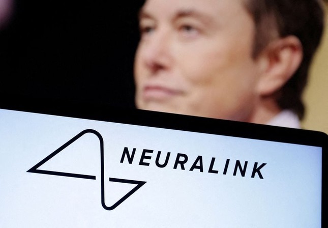 Công ty của tỷ phú Elon Musk lần đầu tiên cấy chip vào não người ảnh 1