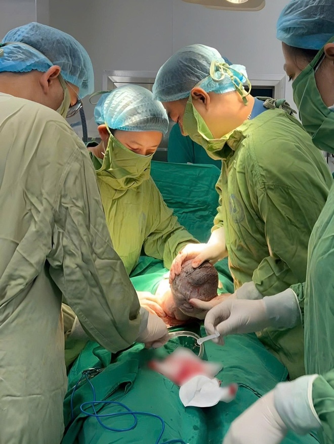thai nhi anh 1