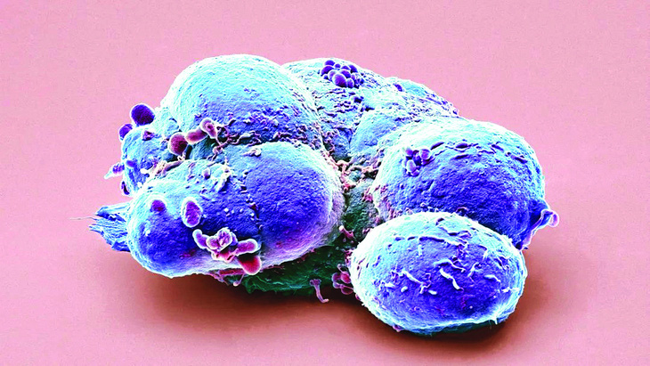 26 năm sau, một kết luận kiên cố về tế bào gốc chữa bệnh- Ảnh 2.