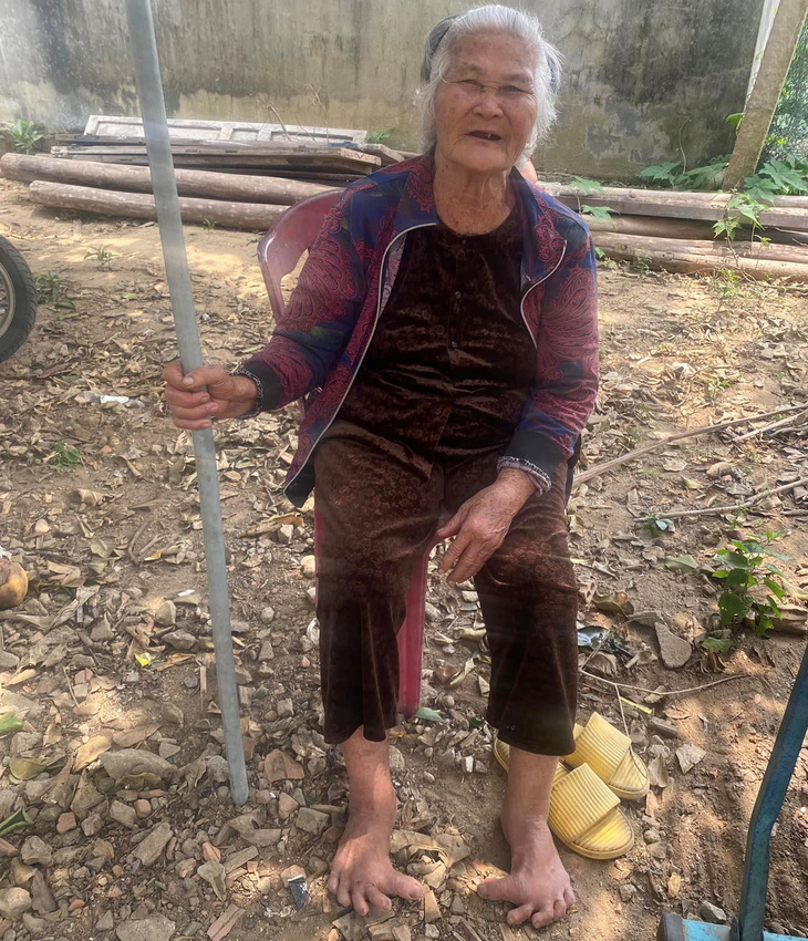 86 tuổi, bà Huyên còn khỏe và minh mẫn, bà vẫn làm việc, bán rau. Nhưng bàn chân kỳ lạ dần thành gánh nặng dễ khiến bà bị ngã