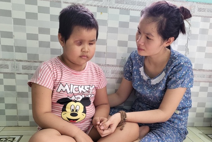 Người mẹ nghèo cầu xin cứu con gái 6 tuổi mù lòa  - 2