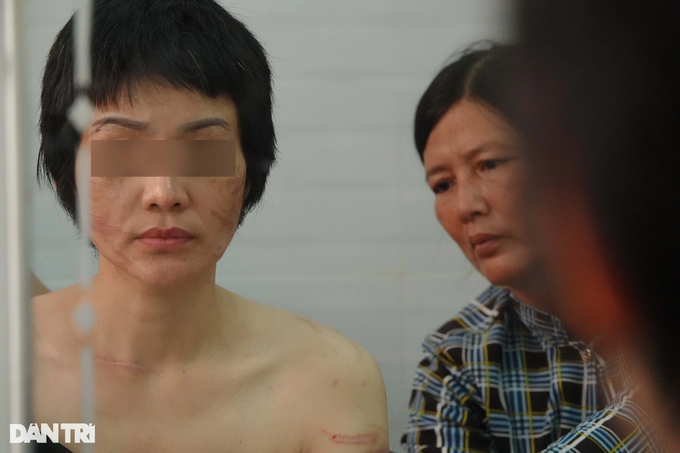Thai phụ Kiên Giang bị chồng bạo hành: Anh ta nói đánh cho tôi chết từ từ - 3
