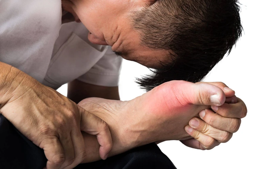 Cơn đau do gút cấp thường xảy ra dữ dội ở các khớp